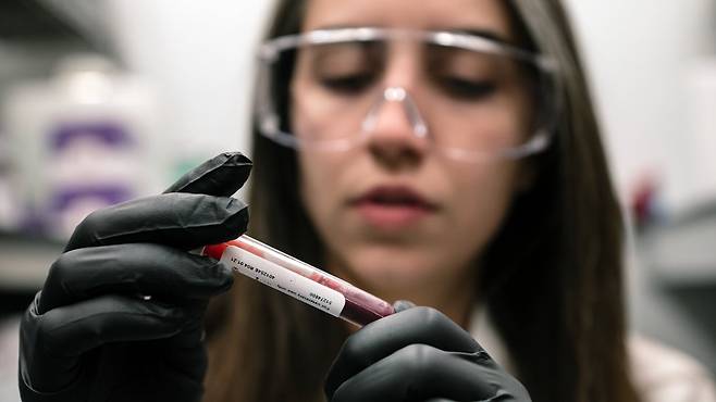 [사이언스샷] 당뇨병에 강한 티베트인, 비밀은 적혈구